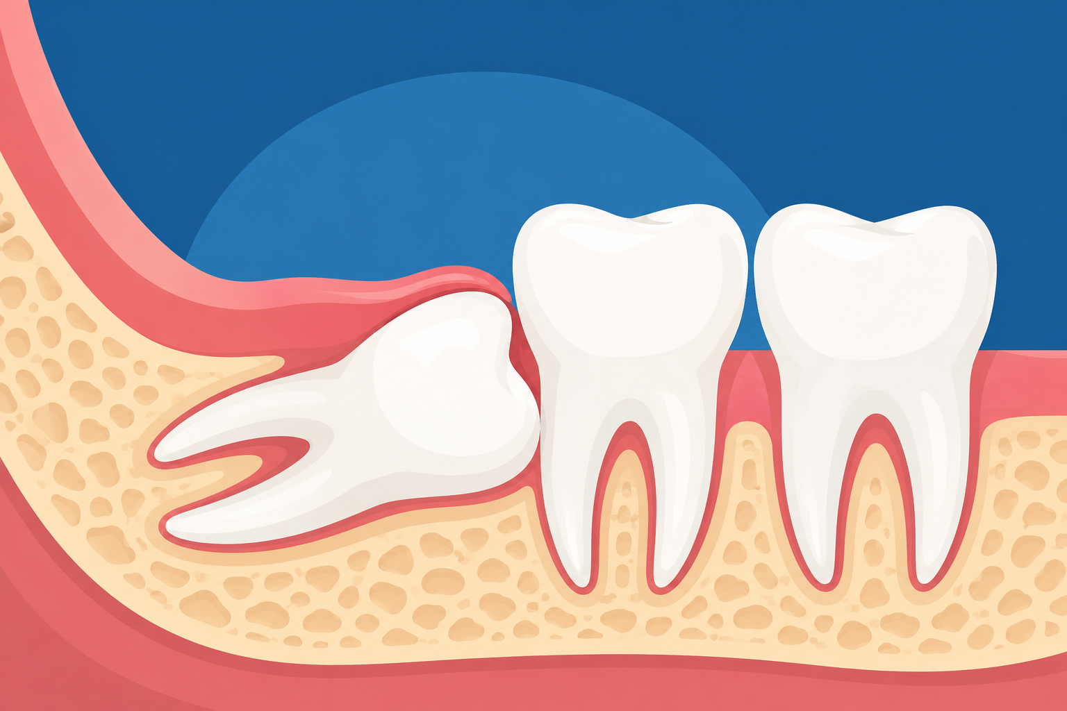 Featured image for Sideways Wisdom Teeth? What Patients Should Expect